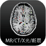 影像解剖图谱