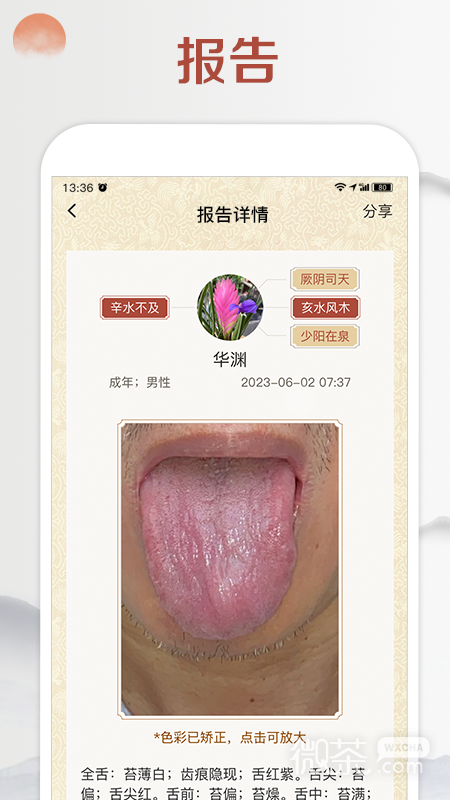 看舌头